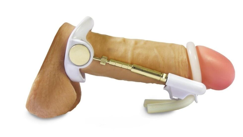Burn Extender para um membro
